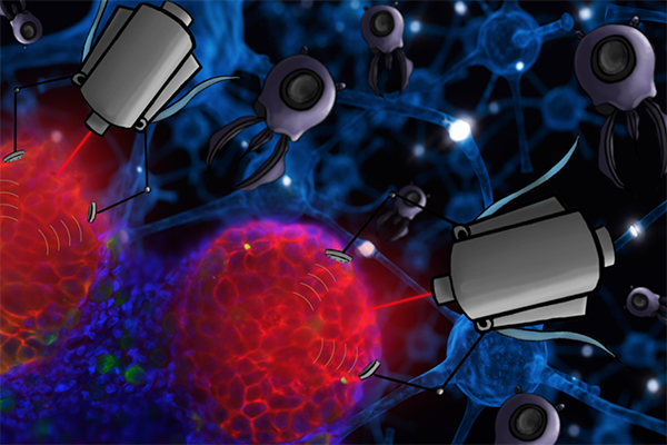 Nano treatment bots cancerous cells elemination concept